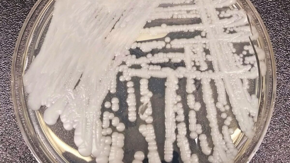 Microscope image of Candida auris fungal cells