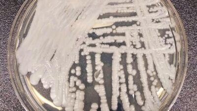 Microscope image of Candida auris fungal cells