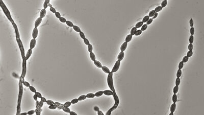 Microscope image of chains of Cladophialophora bantiana fungal cells