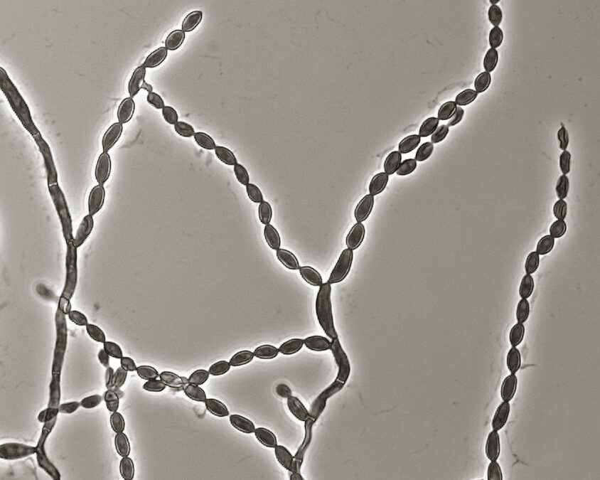 Microscope image of chains of Cladophialophora bantiana fungal cells