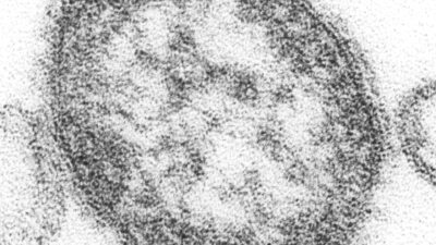 Measles virus particle under electron microscope