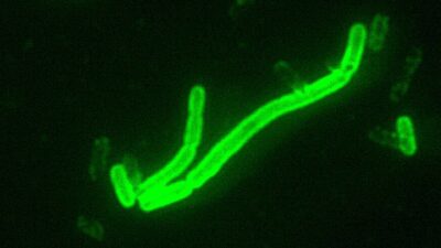 Fluorescent microscope image of rod-shaped Yersinia pestis bacteria, the cause of plague